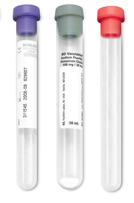 Schilddrüsen-Beispielsammlungs-EDTA-Sammlungs-Rohre für Gerinnungs-Test